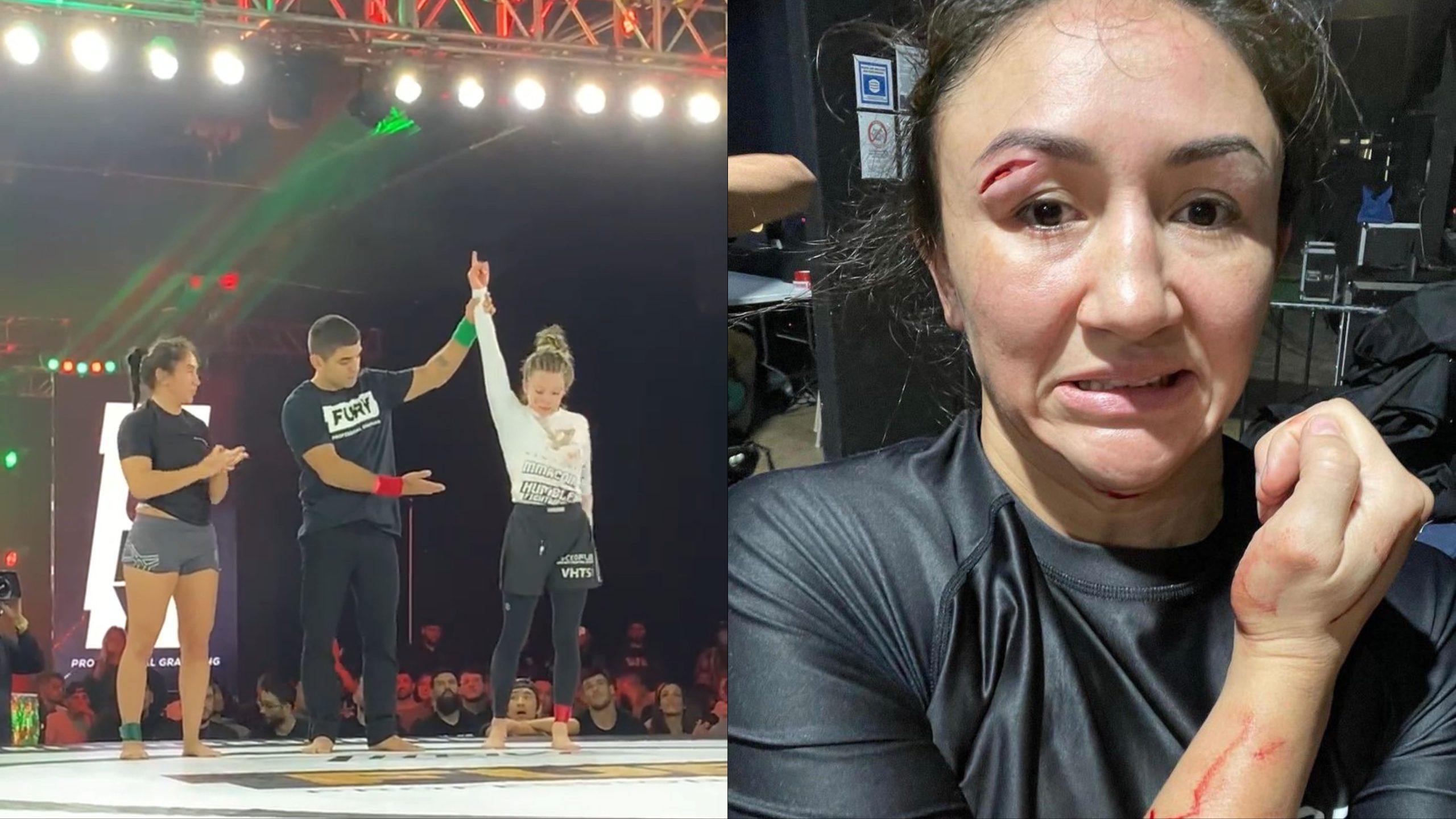 WATCH: UFC Strawweight Carla Esparza Suffers a Nasty Cut on Her Eye in Her ...