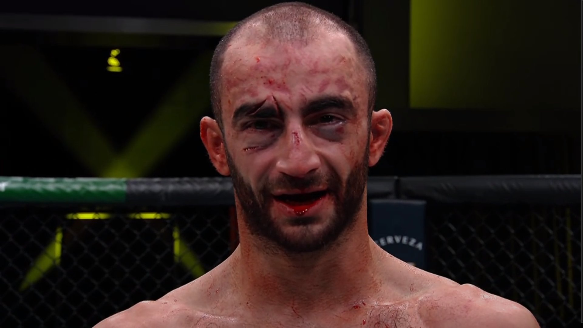 Giga Chikadze Suffers Gruesome Injuries in Fight Against Calvin Kattar,  Sent to Hospital After UFC Vegas 46 - Sportsmanor
